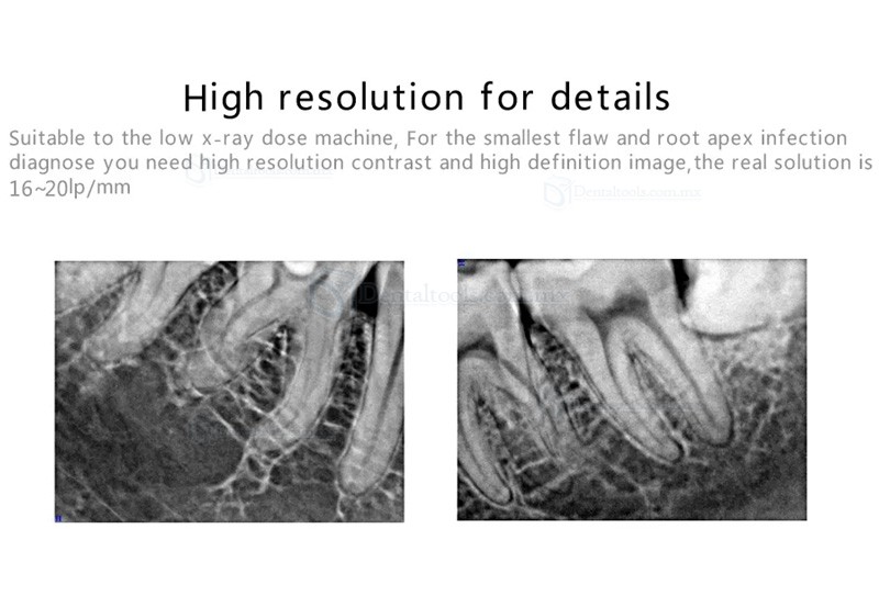 Handy HDR 500B sensores intraorales rayos x radiologia digital dental USB